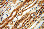 RUVBL2 Antibody in Immunohistochemistry (Paraffin) (IHC (P))