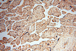 RUVBL2 Antibody in Immunohistochemistry (Paraffin) (IHC (P))