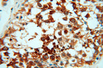 RUVBL2 Antibody in Immunohistochemistry (Paraffin) (IHC (P))