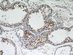 HDAC1 Antibody in Immunohistochemistry (Paraffin) (IHC (P))