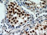 HDAC1 Antibody in Immunohistochemistry (Paraffin) (IHC (P))