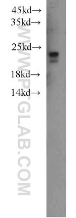 Ubiquitin Polyclonal Antibody (10201-2-AP)