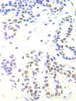 APEX1 Antibody in Immunohistochemistry (Paraffin) (IHC (P))