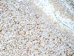 SNRPA Antibody in Immunohistochemistry (Paraffin) (IHC (P))