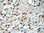 SNRPA Antibody in Immunohistochemistry (Paraffin) (IHC (P))