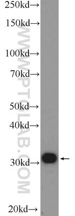 SNRPA Antibody in Western Blot (WB)