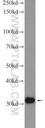 SNRPA Antibody in Western Blot (WB)