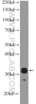 SNRPA Antibody in Western Blot (WB)