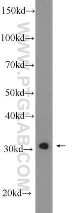 SNRPA Antibody in Western Blot (WB)