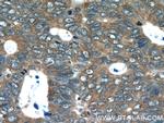 CDC37 Antibody in Immunohistochemistry (Paraffin) (IHC (P))