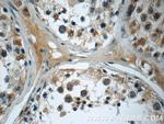 SMAD4 Antibody in Immunohistochemistry (Paraffin) (IHC (P))