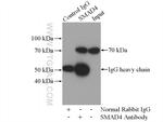 SMAD4 Antibody in Immunoprecipitation (IP)