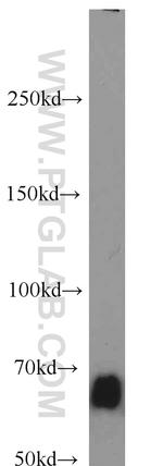 SMAD4 Antibody in Western Blot (WB)