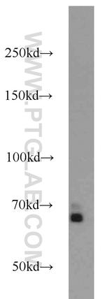 SMAD4 Antibody in Western Blot (WB)