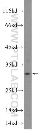 TIP30 Antibody in Western Blot (WB)