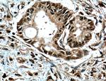 GRB2 Antibody in Immunohistochemistry (Paraffin) (IHC (P))