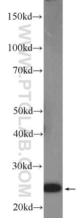 GRB2 Antibody in Western Blot (WB)