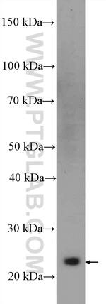 GRB2 Antibody in Western Blot (WB)