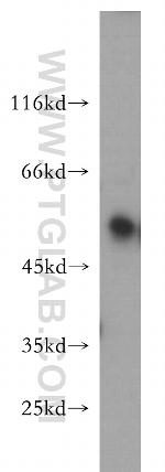 SNX17 Antibody in Western Blot (WB)