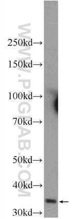 AMPK gamma 1 Antibody in Western Blot (WB)