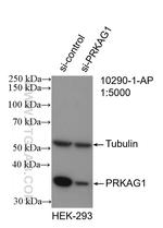 AMPK gamma 1 Antibody in Western Blot (WB)