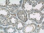 CIAO1 Antibody in Immunohistochemistry (Paraffin) (IHC (P))