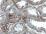 CIAO1 Antibody in Immunohistochemistry (Paraffin) (IHC (P))