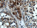 CIAO1 Antibody in Immunohistochemistry (Paraffin) (IHC (P))