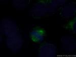 Aurora A Antibody in Immunocytochemistry (ICC/IF)