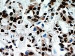 B23/NPM1 Antibody in Immunohistochemistry (Paraffin) (IHC (P))