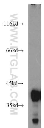 B23/NPM1 Antibody in Western Blot (WB)