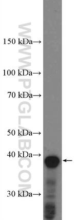 B23/NPM1 Antibody in Western Blot (WB)