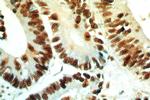 B23/NPM1 Antibody in Immunohistochemistry (Paraffin) (IHC (P))