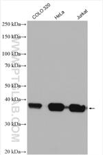 B23/NPM1 Antibody in Western Blot (WB)