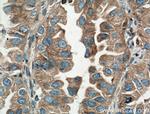 AMPK beta 1 Antibody in Immunohistochemistry (Paraffin) (IHC (P))