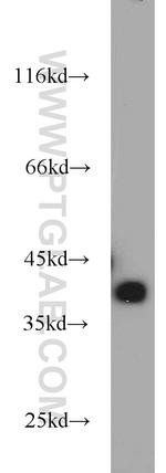 AMPK beta 1 Antibody in Western Blot (WB)