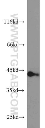 AMPK beta 1 Antibody in Western Blot (WB)