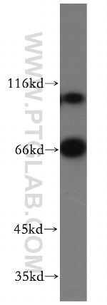 WBP11 Antibody in Western Blot (WB)