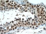 SUMO1 Antibody in Immunohistochemistry (Paraffin) (IHC (P))