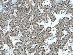 UBE3A Antibody in Immunohistochemistry (Paraffin) (IHC (P))