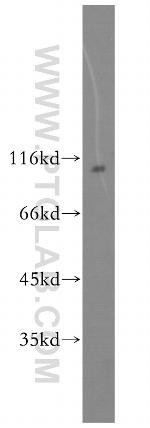 UBE3A Antibody in Western Blot (WB)