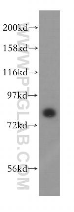 NCBP1 Antibody in Western Blot (WB)