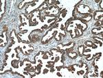 ALDH7A1 Antibody in Immunohistochemistry (Paraffin) (IHC (P))