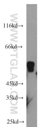 ALDH7A1 Antibody in Western Blot (WB)