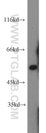 ALDH7A1 Antibody in Western Blot (WB)