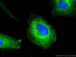 Cytokeratin 8 Antibody in Immunocytochemistry (ICC/IF)