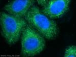 Cytokeratin 8 Antibody in Immunocytochemistry (ICC/IF)