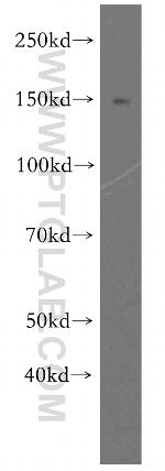 FMNL1 Antibody in Western Blot (WB)