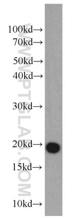 DR1 Antibody in Western Blot (WB)