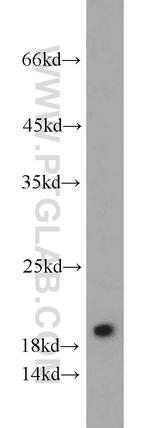 DR1 Antibody in Western Blot (WB)